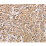 Immunohistochemistry - WNT11 Antibody from Signalway Antibody (36136) - Antibodies.com