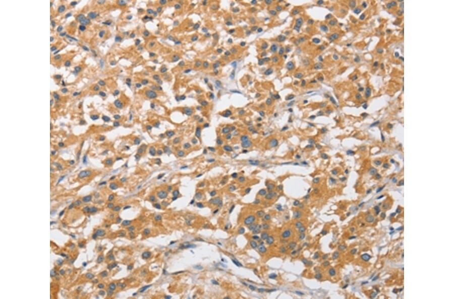 Immunohistochemistry - ARL8A Antibody from Signalway Antibody (36138) - Antibodies.com