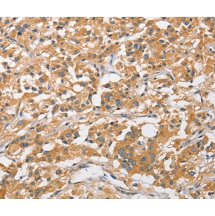 Immunohistochemistry - ARL8A Antibody from Signalway Antibody (36138) - Antibodies.com