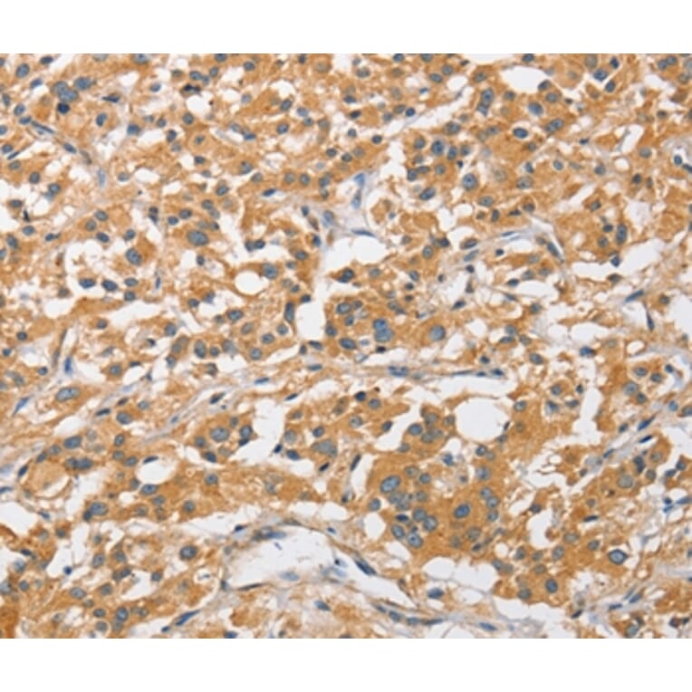 Immunohistochemistry - ARL8A Antibody from Signalway Antibody (36138) - Antibodies.com