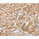 Immunohistochemistry - ARL8A Antibody from Signalway Antibody (36138) - Antibodies.com