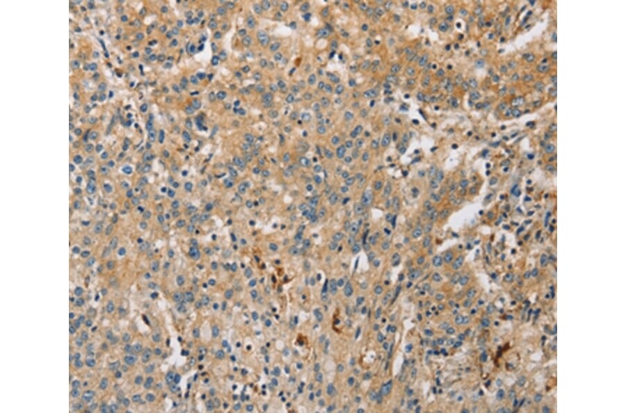 Immunohistochemistry - ARL8A Antibody from Signalway Antibody (36138) - Antibodies.com