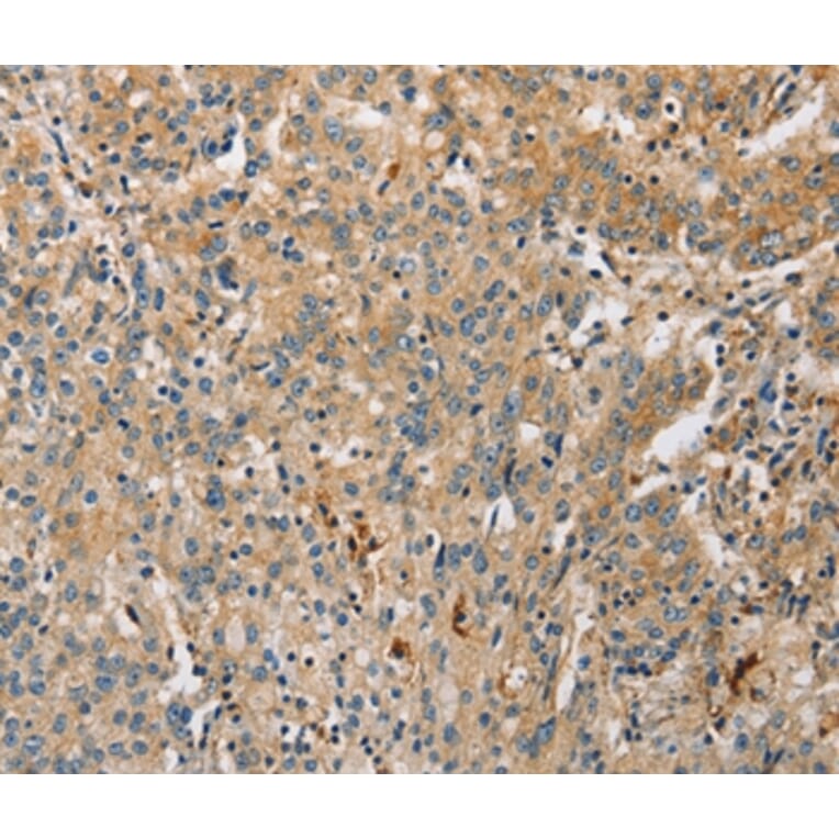 Immunohistochemistry - ARL8A Antibody from Signalway Antibody (36138) - Antibodies.com