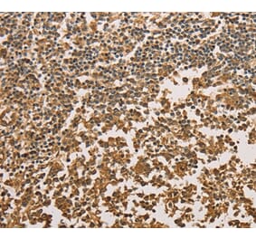 Immunohistochemistry - SETD2 Antibody from Signalway Antibody (36150) - Antibodies.com