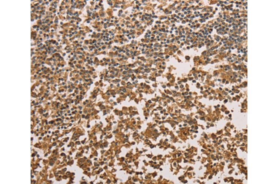 Immunohistochemistry - SETD2 Antibody from Signalway Antibody (36150) - Antibodies.com