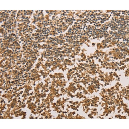 Immunohistochemistry - SETD2 Antibody from Signalway Antibody (36150) - Antibodies.com
