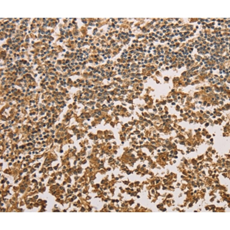 Immunohistochemistry - SETD2 Antibody from Signalway Antibody (36150) - Antibodies.com