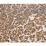 Immunohistochemistry - SETD2 Antibody from Signalway Antibody (36150) - Antibodies.com