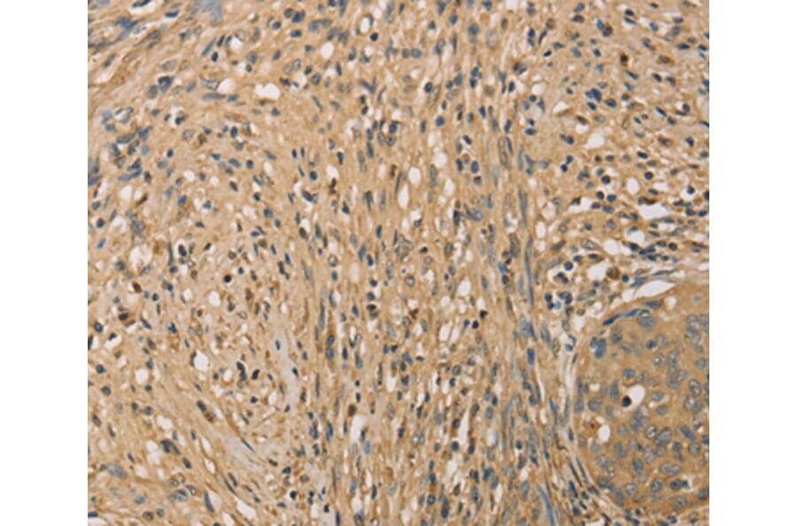Immunohistochemistry - SETD2 Antibody from Signalway Antibody (36150) - Antibodies.com