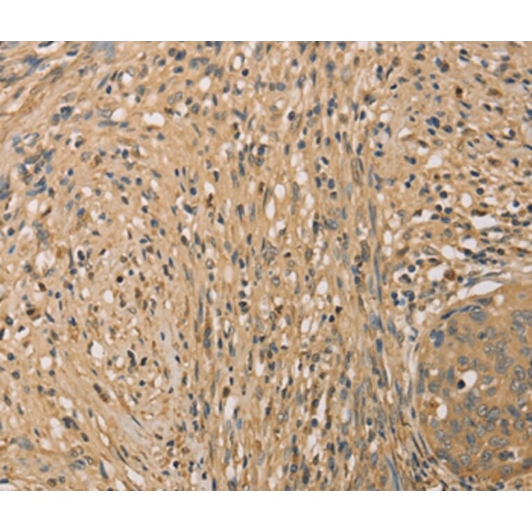 Immunohistochemistry - SETD2 Antibody from Signalway Antibody (36150) - Antibodies.com