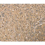 Immunohistochemistry - SETD2 Antibody from Signalway Antibody (36150) - Antibodies.com