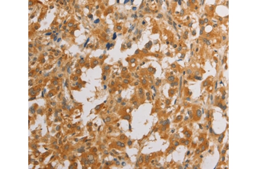 Immunohistochemistry - ATG4D Antibody from Signalway Antibody (36156) - Antibodies.com