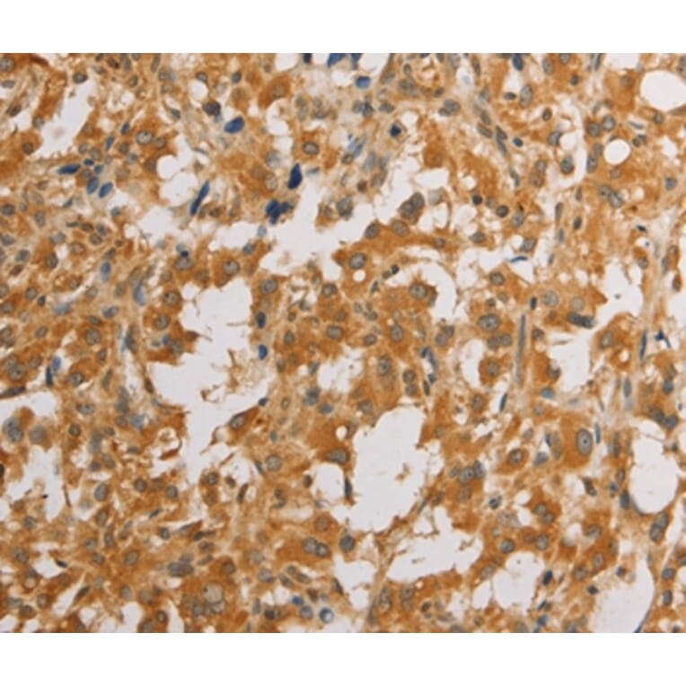 Immunohistochemistry - ATG4D Antibody from Signalway Antibody (36156) - Antibodies.com