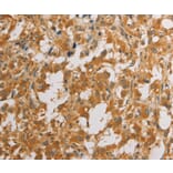 Immunohistochemistry - ATG4D Antibody from Signalway Antibody (36156) - Antibodies.com