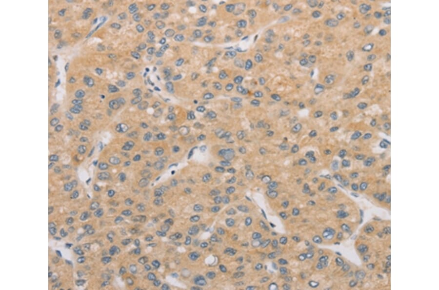 Immunohistochemistry - ATG4D Antibody from Signalway Antibody (36156) - Antibodies.com