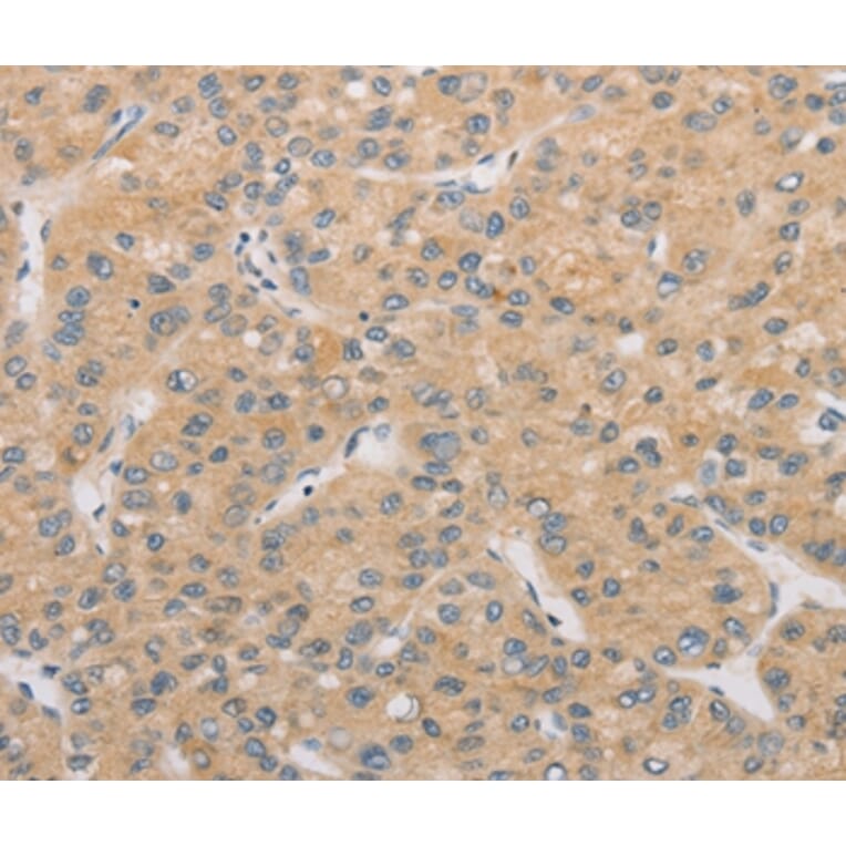 Immunohistochemistry - ATG4D Antibody from Signalway Antibody (36156) - Antibodies.com