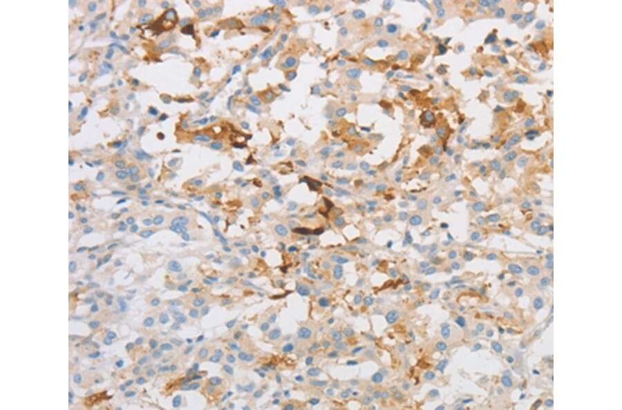 Immunohistochemistry - OLFM1 Antibody from Signalway Antibody (36178) - Antibodies.com