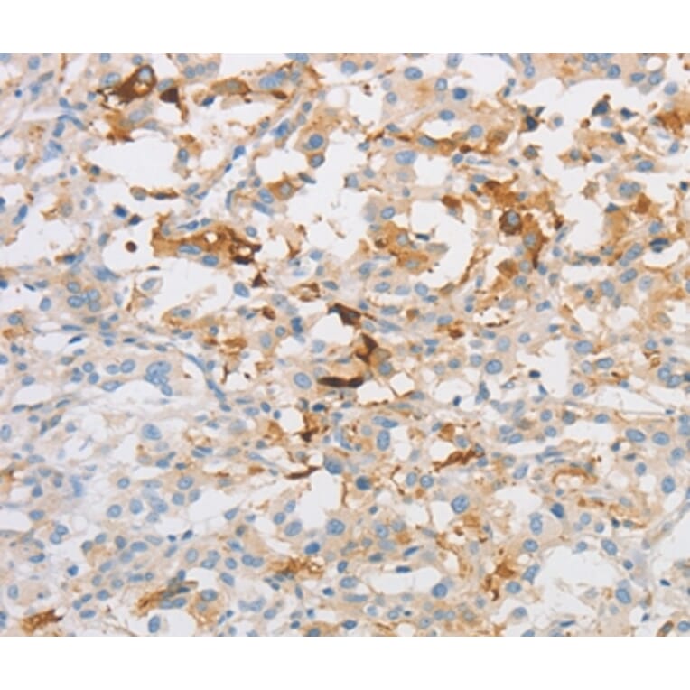 Immunohistochemistry - OLFM1 Antibody from Signalway Antibody (36178) - Antibodies.com