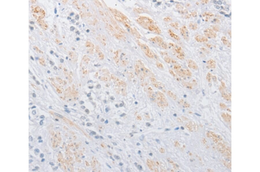 Immunohistochemistry - OLFM1 Antibody from Signalway Antibody (36178) - Antibodies.com