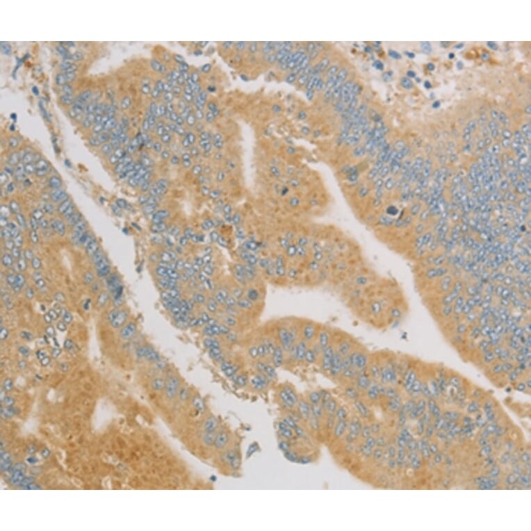 Immunohistochemistry - KLF17 Antibody from Signalway Antibody (36181) - Antibodies.com