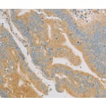 Immunohistochemistry - KLF17 Antibody from Signalway Antibody (36181) - Antibodies.com