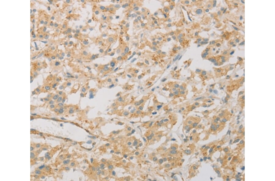 Immunohistochemistry - KLF17 Antibody from Signalway Antibody (36181) - Antibodies.com