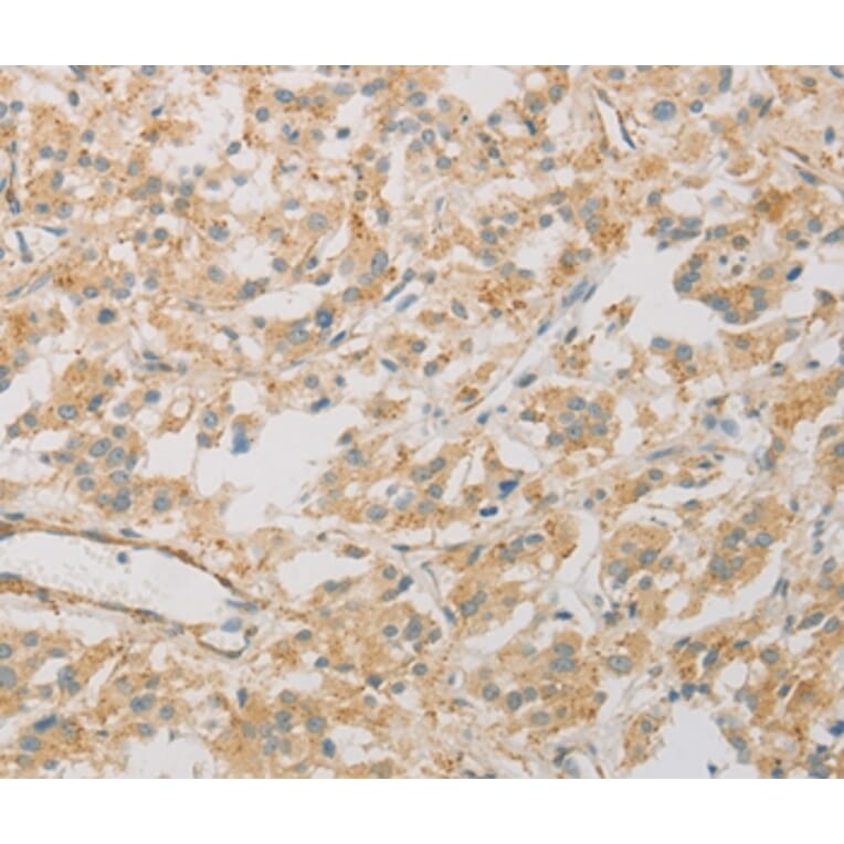 Immunohistochemistry - KLF17 Antibody from Signalway Antibody (36181) - Antibodies.com