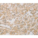 Immunohistochemistry - KLF17 Antibody from Signalway Antibody (36181) - Antibodies.com