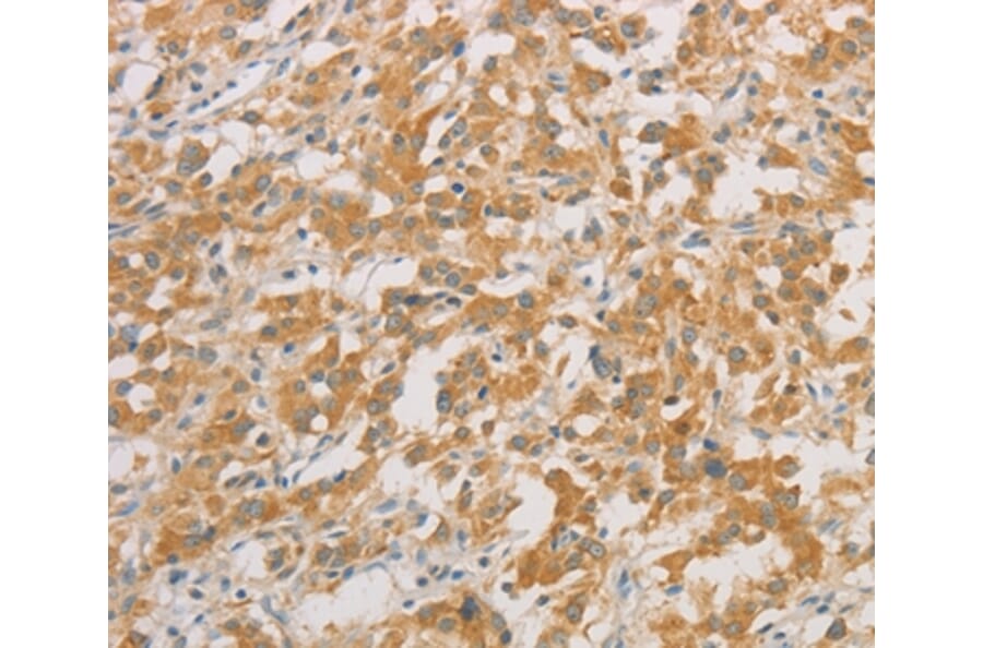 Immunohistochemistry - ZWINT Antibody from Signalway Antibody (36183) - Antibodies.com