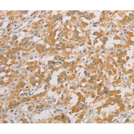 Immunohistochemistry - ZWINT Antibody from Signalway Antibody (36183) - Antibodies.com