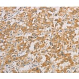Immunohistochemistry - ZWINT Antibody from Signalway Antibody (36183) - Antibodies.com