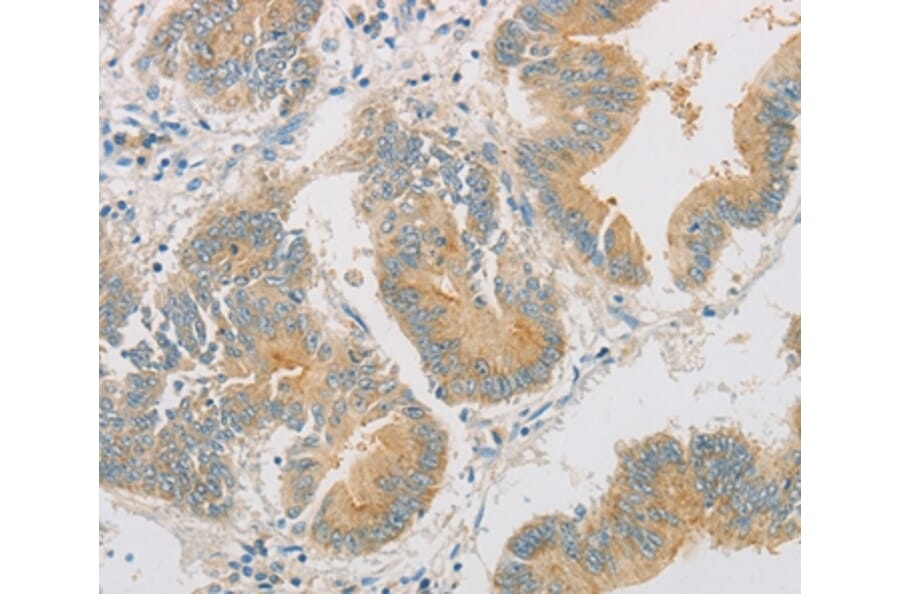 Immunohistochemistry - ZWINT Antibody from Signalway Antibody (36183) - Antibodies.com