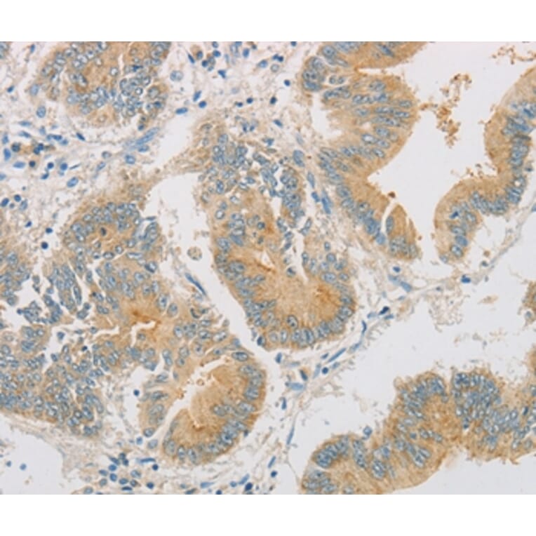 Immunohistochemistry - ZWINT Antibody from Signalway Antibody (36183) - Antibodies.com