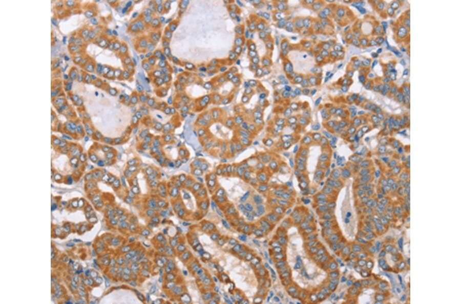 Immunohistochemistry - MTMR7 Antibody from Signalway Antibody (36184) - Antibodies.com