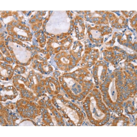 Immunohistochemistry - MTMR7 Antibody from Signalway Antibody (36184) - Antibodies.com