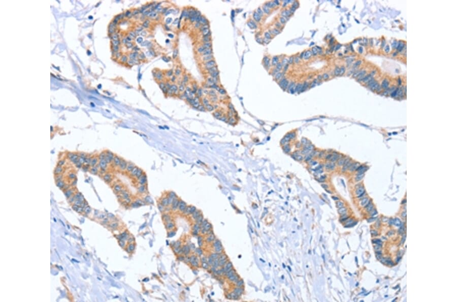 Immunohistochemistry - MTMR7 Antibody from Signalway Antibody (36184) - Antibodies.com
