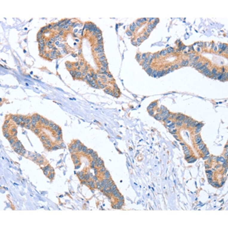 Immunohistochemistry - MTMR7 Antibody from Signalway Antibody (36184) - Antibodies.com