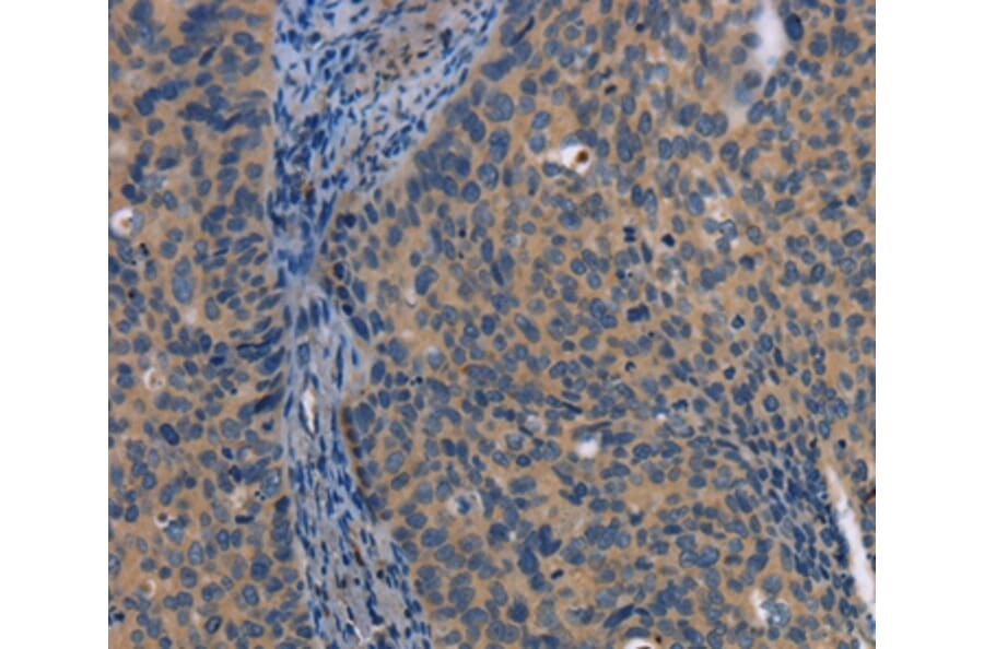 Immunohistochemistry - LATS1 Antibody from Signalway Antibody (36187) - Antibodies.com