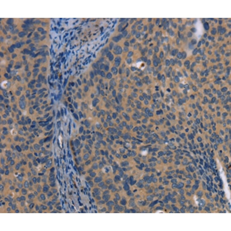 Immunohistochemistry - LATS1 Antibody from Signalway Antibody (36187) - Antibodies.com