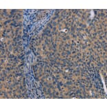 Immunohistochemistry - LATS1 Antibody from Signalway Antibody (36187) - Antibodies.com