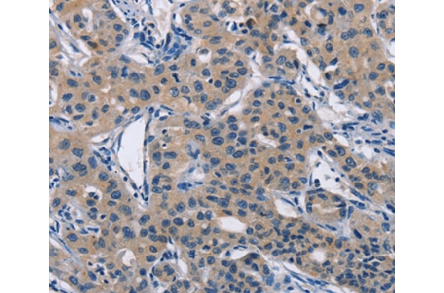 Immunohistochemistry - LATS1 Antibody from Signalway Antibody (36187) - Antibodies.com