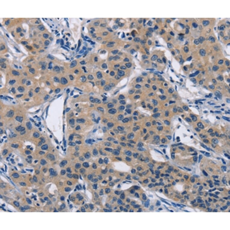 Immunohistochemistry - LATS1 Antibody from Signalway Antibody (36187) - Antibodies.com