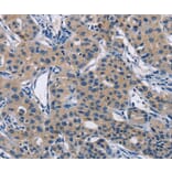 Immunohistochemistry - LATS1 Antibody from Signalway Antibody (36187) - Antibodies.com