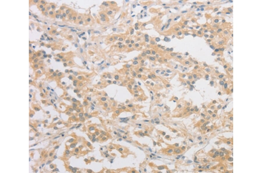 Immunohistochemistry - HIPK4 Antibody from Signalway Antibody (36191) - Antibodies.com