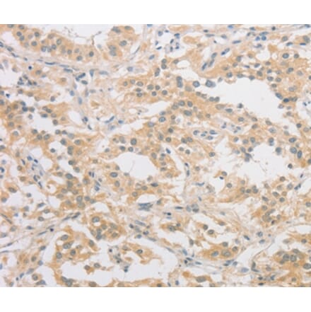 Immunohistochemistry - HIPK4 Antibody from Signalway Antibody (36191) - Antibodies.com