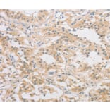 Immunohistochemistry - HIPK4 Antibody from Signalway Antibody (36191) - Antibodies.com