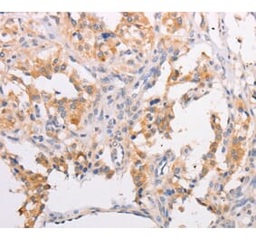 Immunohistochemistry - MYLK3 Antibody from Signalway Antibody (36204) - Antibodies.com