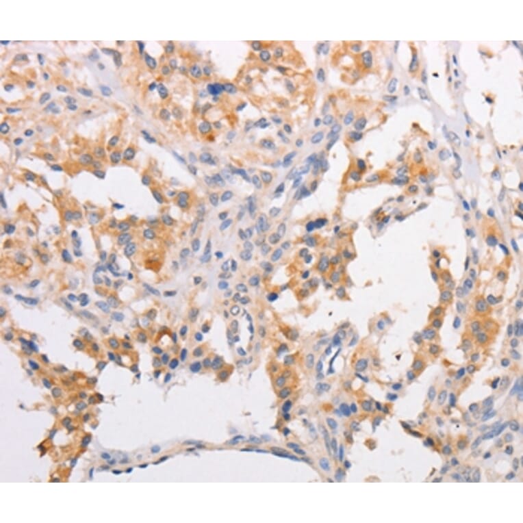 Immunohistochemistry - MYLK3 Antibody from Signalway Antibody (36204) - Antibodies.com