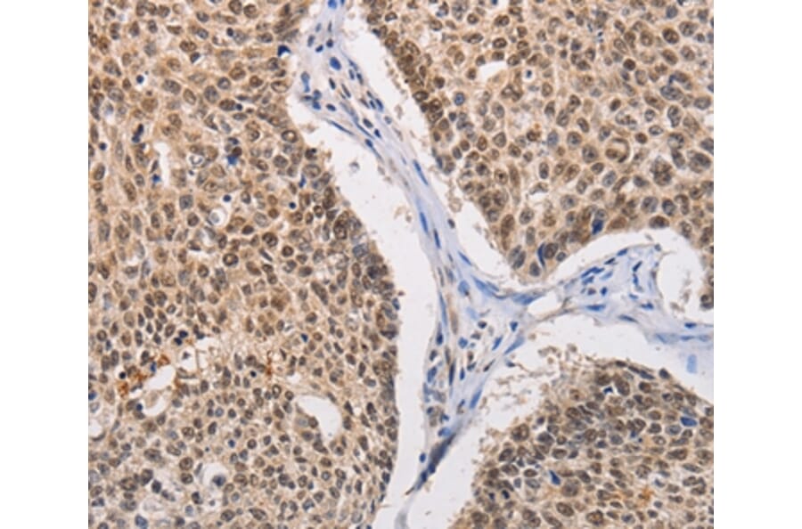 Immunohistochemistry - MYLK3 Antibody from Signalway Antibody (36204) - Antibodies.com