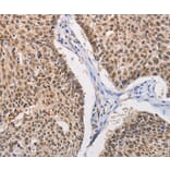 Immunohistochemistry - MYLK3 Antibody from Signalway Antibody (36204) - Antibodies.com